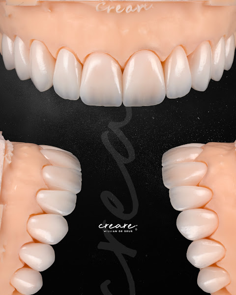 Foto 3 de Creare Willian de Deus - Laboratório de Prótese Dentária