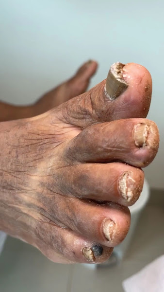 Foto 3 de Crispé Podologia
