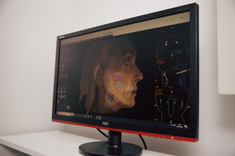 Foto 2 de CRO - Centro de Radiologia Odontológica