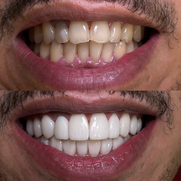 Foto 3 de CROE Odontologia Garavelo