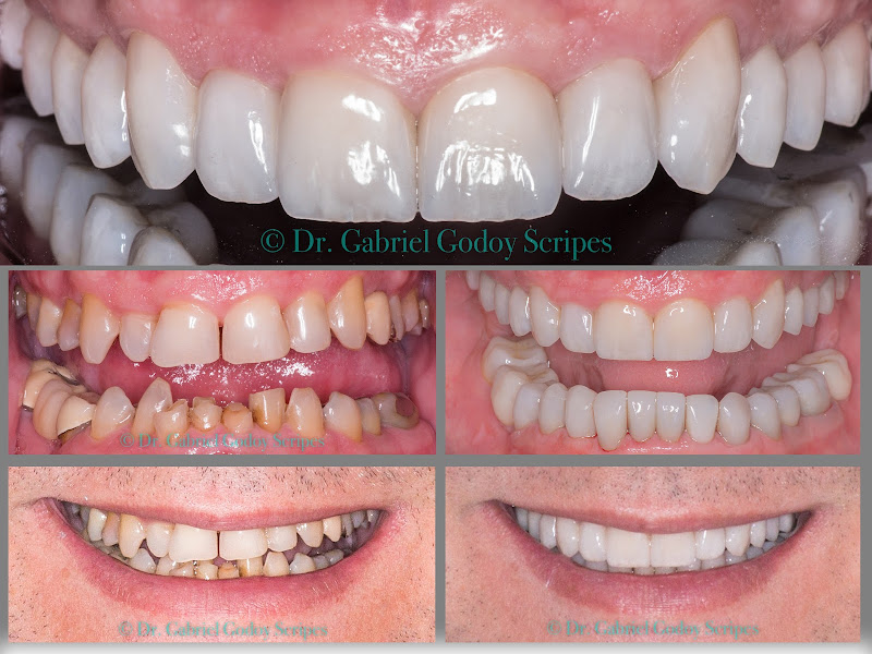 Foto 8 de Crol Odontologia by Dra. Rosemary Carneiro | Ortodontia I Implante Dentário I Estética