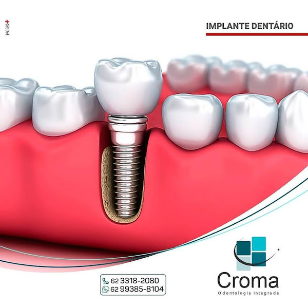 Foto 3 de Croma - Odontologia Integrada