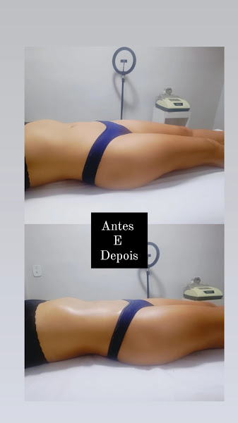 Foto 2 de Crystal Laser centro avançado de estética e depilação a laser