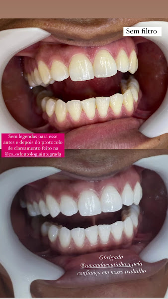 Foto 2 de CS Odontologia Integrada, DRA. CHEILA SOUZA