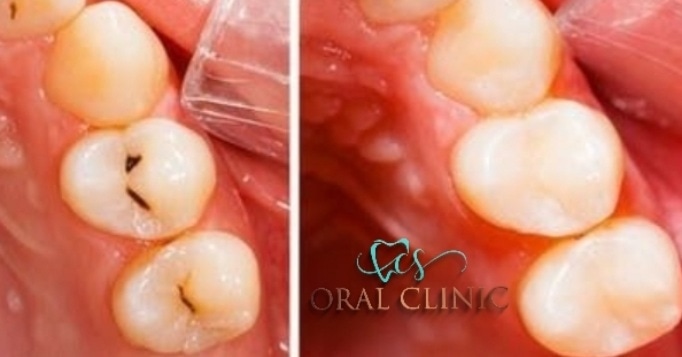 Foto 3 de CS Oral Clinic