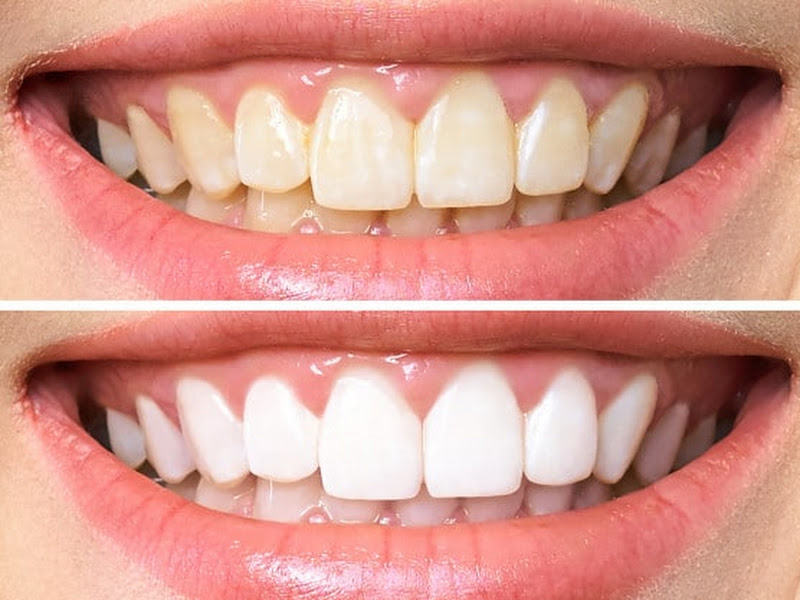 Foto 3 de Cuidando do sorriso do Brasil