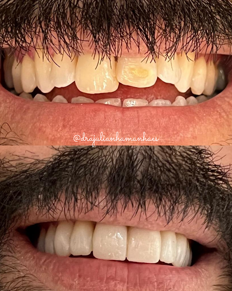 Foto 3 de Cuidar Odontologia |Dentista Macaé |Implantes| Ortodontia|Facetas e lentes de contato|Prótese|Periodontia|Clareamento.