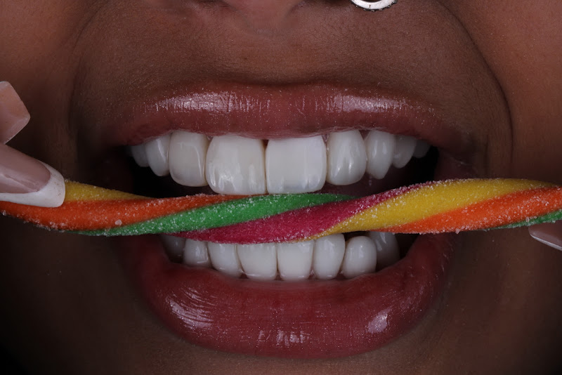 Foto 2 de Curso Facetas de Resina - Dra. Monique Messias Rio de Janeiro