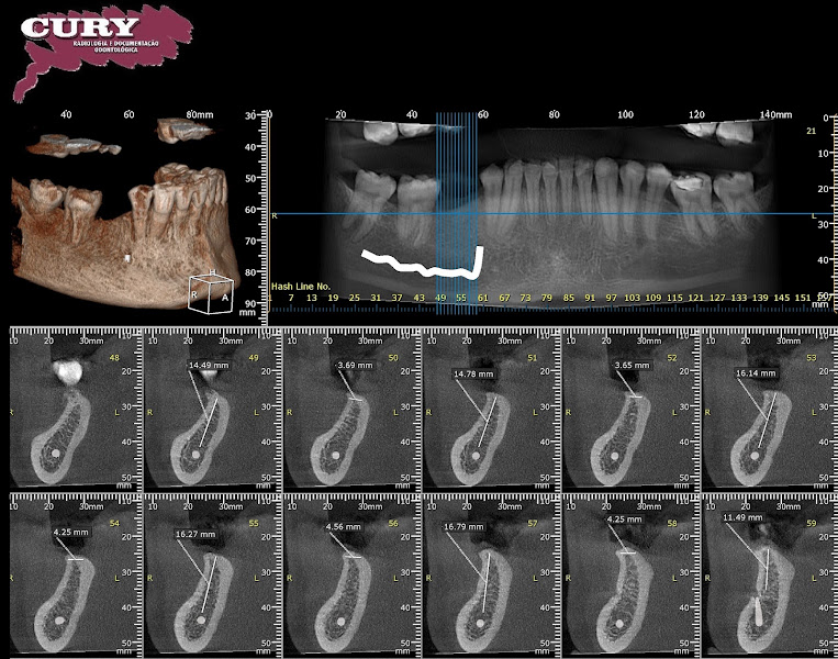 Foto 3 de Cury Radiologia - Unidade Centro - Luiz Faccini