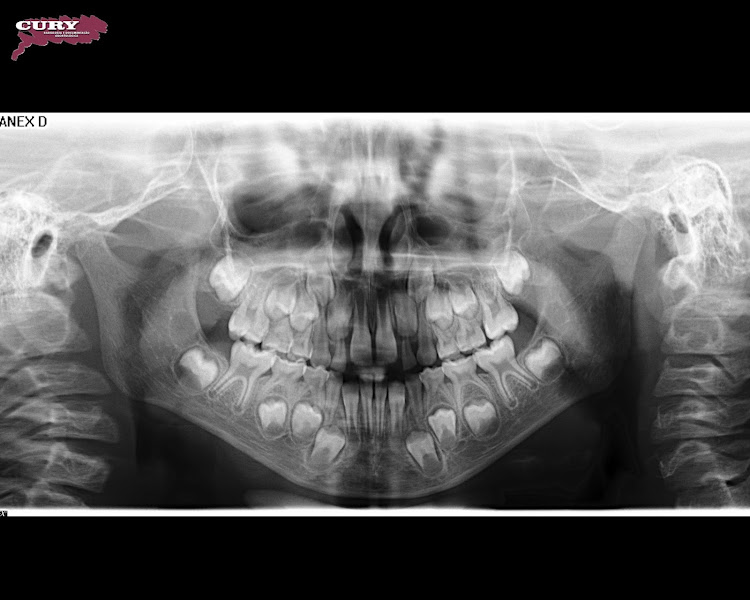 Foto 3 de Cury Radiologia - Unidade Taboão