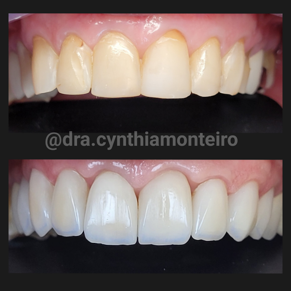 Foto 3 de Cynthia Monteiro Odontologia