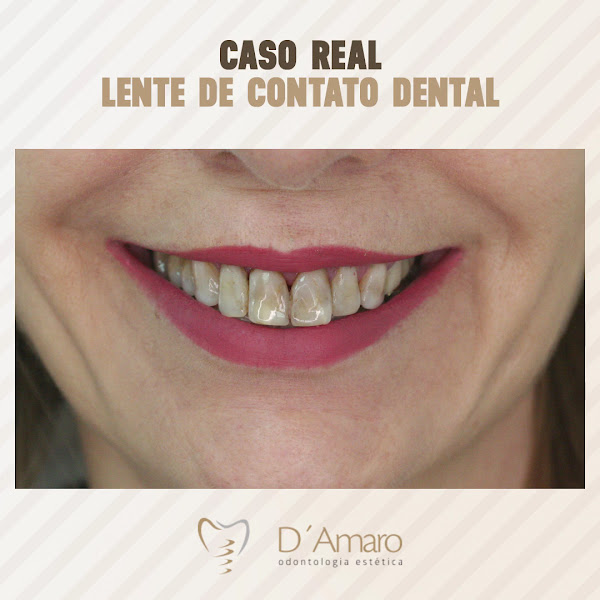 Foto 4 de D'Amaro Odontologia - Dentista