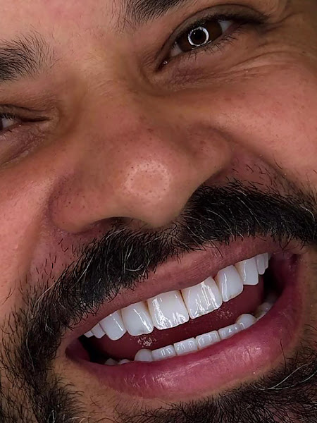 Foto 3 de D+Dents Odontologia e Estética | Jardim Zaira