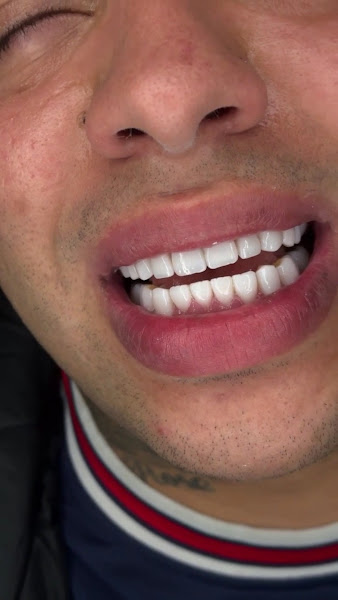 Foto 3 de D+Dents Odontologia e Estética | São João