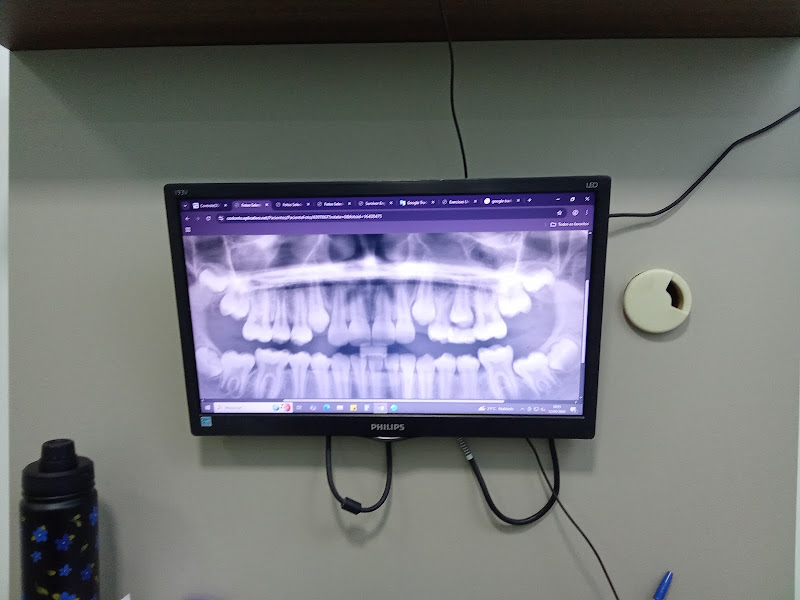 Foto 3 de D+Dents Odontologia e Estética | São Mateus