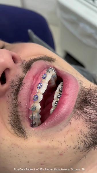 Foto 3 de D.E.M. Odontologia Especializada