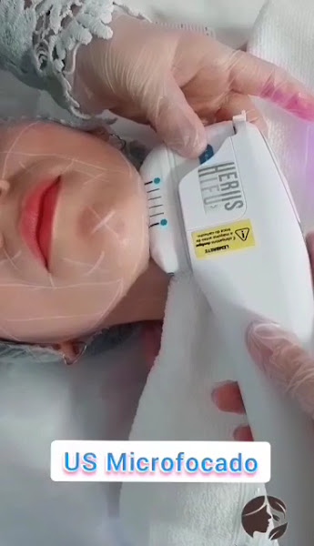 Foto 3 de D'LASER FLORIANO