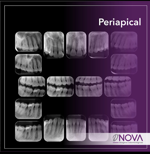 Foto 3 de D'NOVA imagens odontológicas
