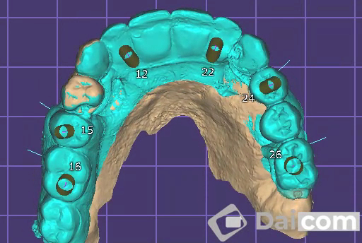 Foto 3 de Daicom - Radiologia Odontológica - Bento Gonçalves/RS