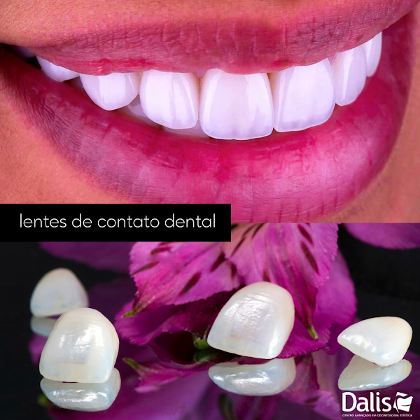 Foto 2 de Dalis Centro Avançado em Odontologia Estética