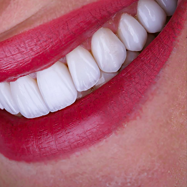 Foto 4 de Dalis Centro Avançado em Odontologia Estética