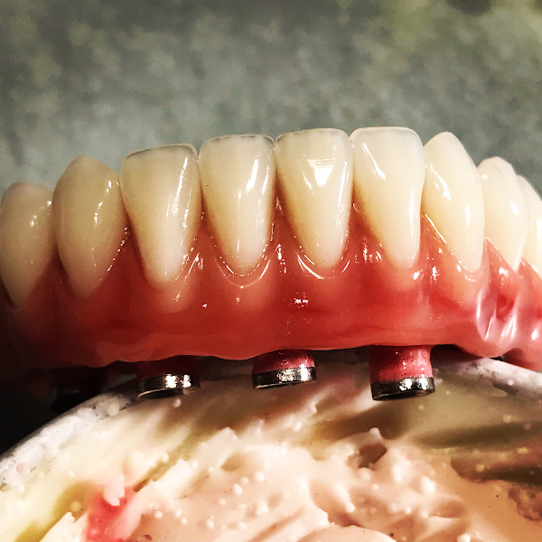 Foto 2 de Danfel - Prótese Odontológica