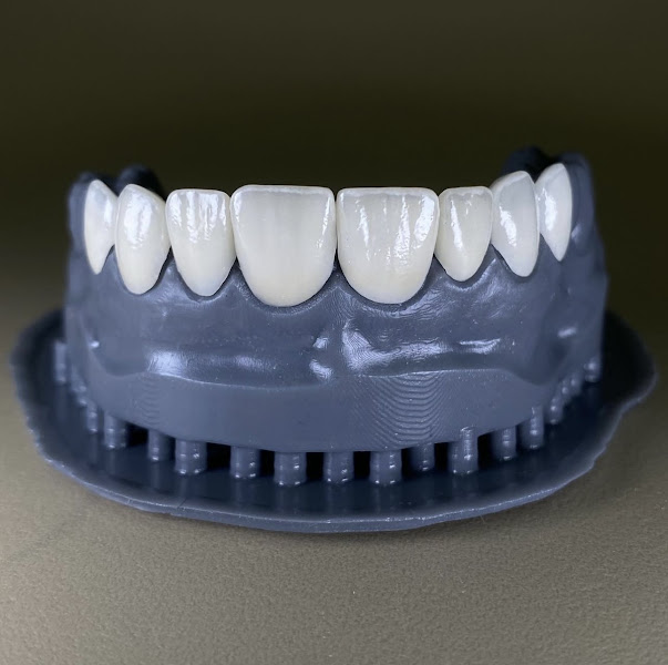 Foto 3 de Danfel - Prótese Odontológica