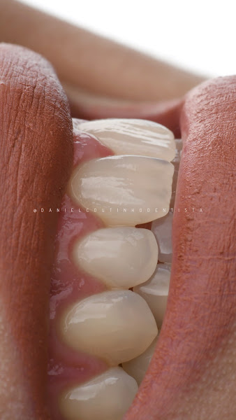 Foto 3 de Dániel Coutinho