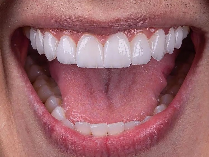 Foto 5 de Dániel Coutinho