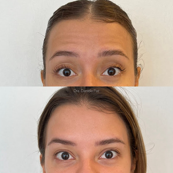 Foto de Daniela Paz - Harmonização Facial em Fortaleza