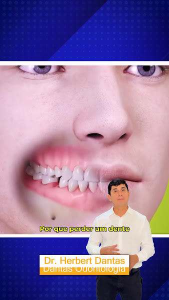 Foto 3 de Dantas Odontologia | Implantes Dentários | Facetas Dentárias | Clareamento Dental - Linhares, ES