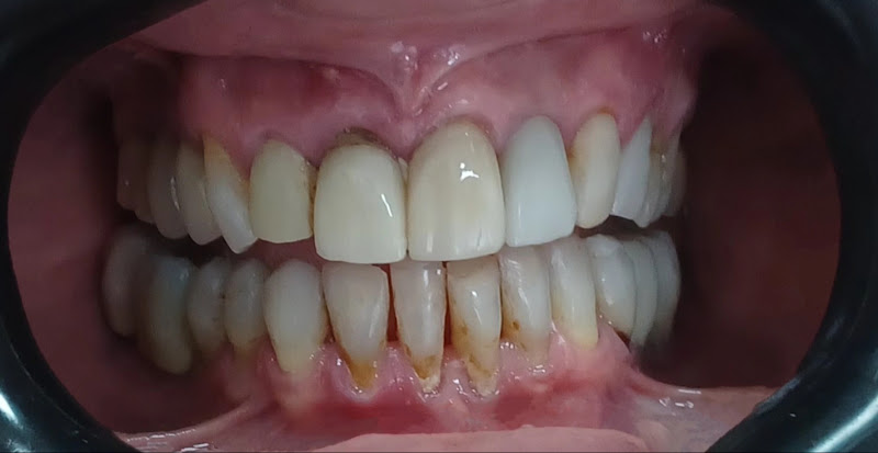 Foto 3 de DD ODONTOLOGIA INTEGRADA Dr Daniel Ferreira Alves, Dra Daniela Calabrese Nunes