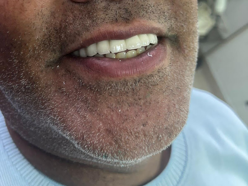 Foto 10 de De Bortholi - Clínica de Odontologia Especializada em Periodontia
