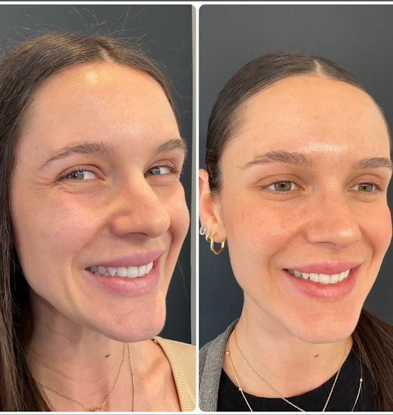 Foto 3 de Deborah Castagno | Referência em Odontologia do Sono e Harmonização Facial