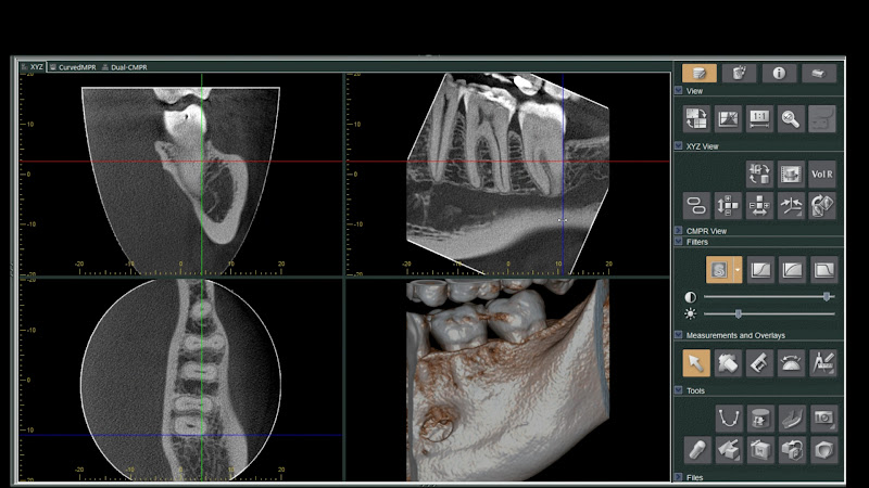 Foto 3 de DEFi Radiologia Odontológica