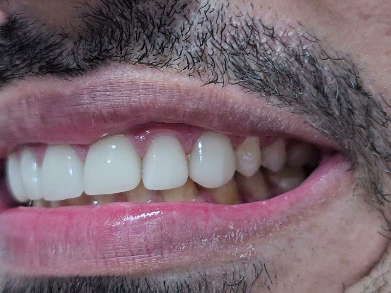 Foto 4 de Definitiva Odontologia