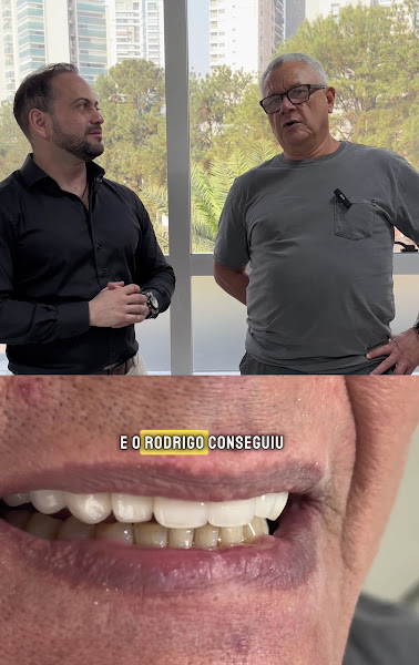 Foto 3 de Del Fiaco Odontologia | Lentes em Porcelana