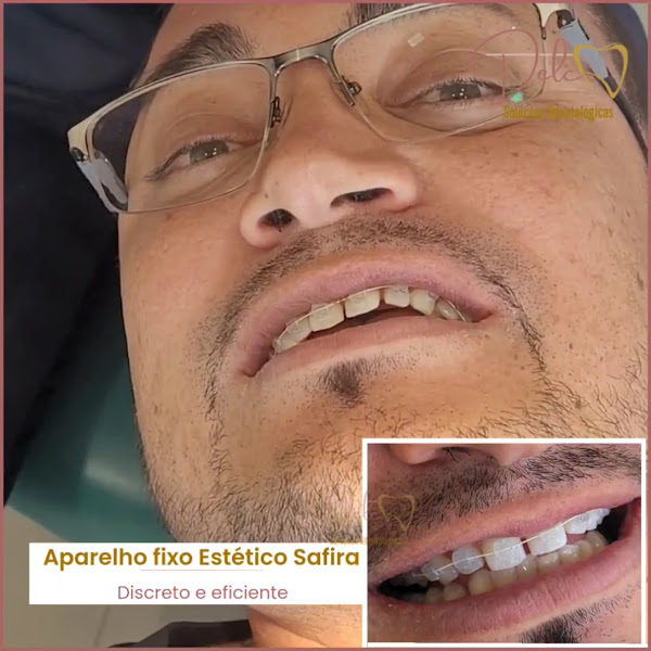 Foto 4 de Delc Clínica Odontológica Especializada | Clareamento Dental