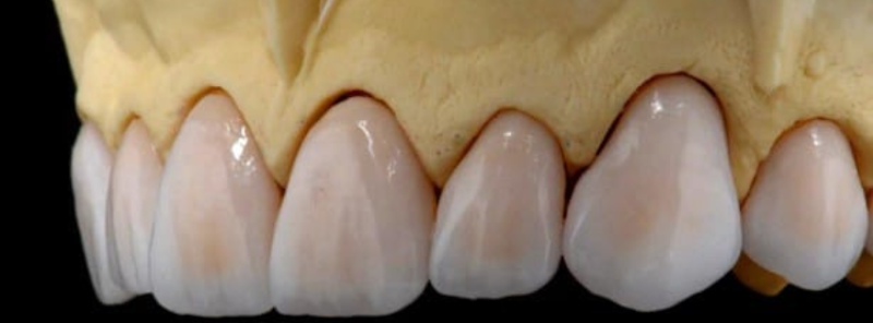 Foto 2 de Dembicki | Reabilitação oral