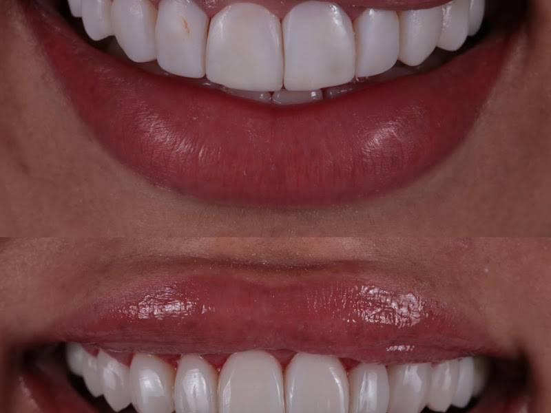 Foto 2 de DenLife-Odontologia - Dr. Norberto Sobrinho e Dra. Claudia Storti