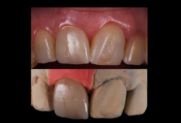 Foto 2 de Dent Design