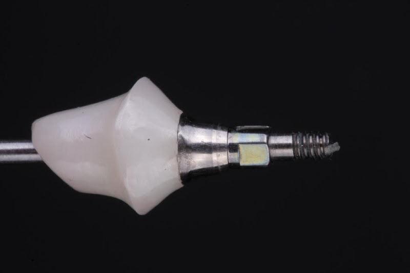 Foto 3 de Dent Design