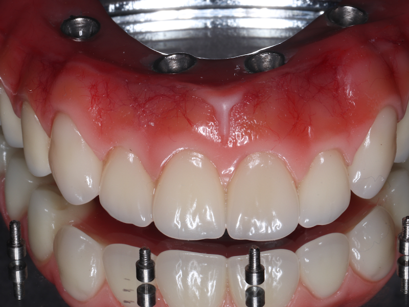 Foto 3 de Dent Oito Odontologia