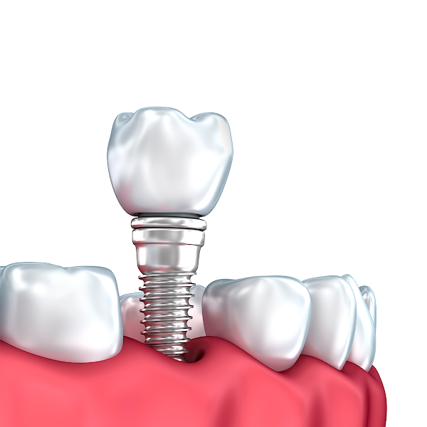 Foto 3 de Dental Arte Andradas