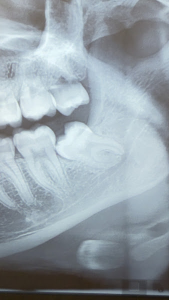 Foto 3 de Dental Atelier Bruno Teixeira