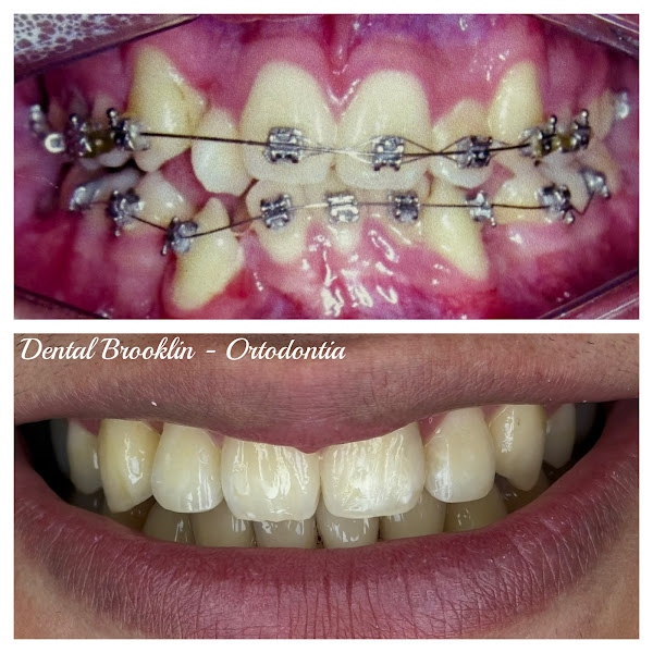 Foto 3 de Dental Brooklin