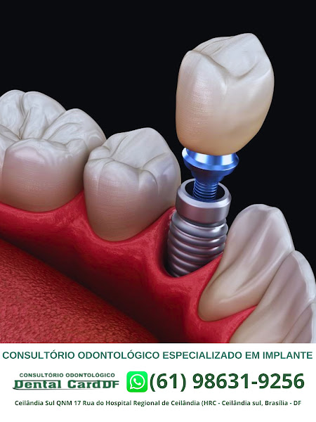Foto 3 de Dental Card Ceilândia Sul