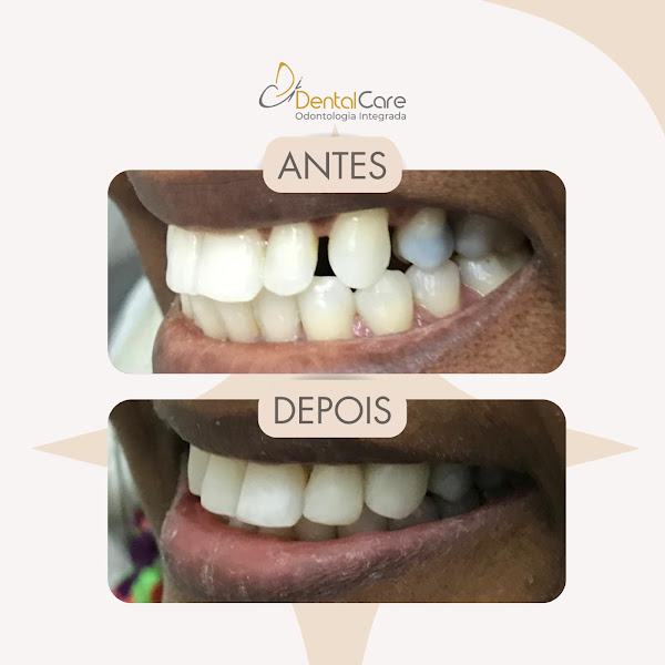Foto 3 de Dental Care | Clínica Odontológica - Mundo Plaza