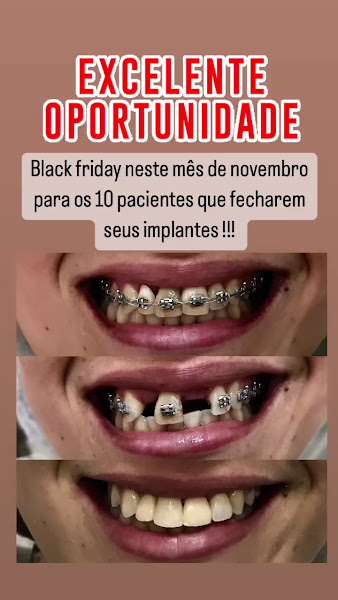 Foto 3 de DENTAL CLEAN