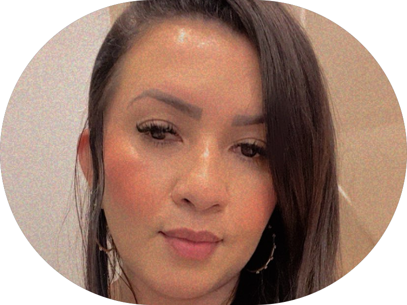 Foto 4 de Dental Clean – Implantes Dentários, Facetas em Resina e Lentes de Contato Dental